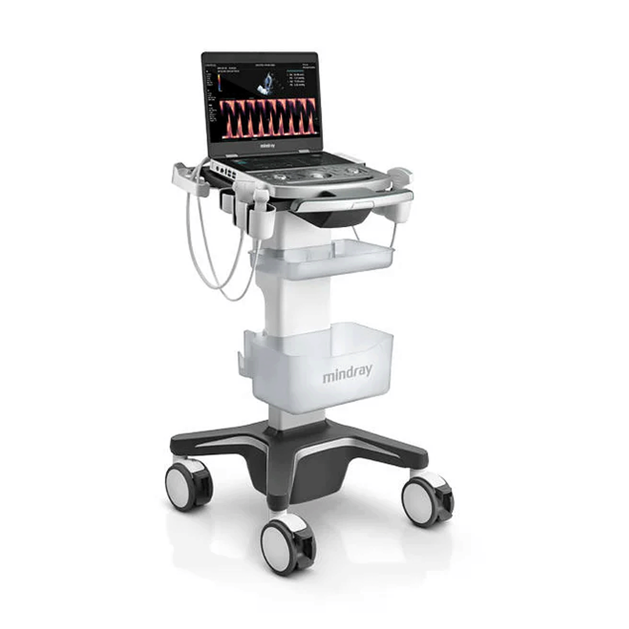 Mindray MX8 MSK Ultrasound Machine – Ultrasounds MD
